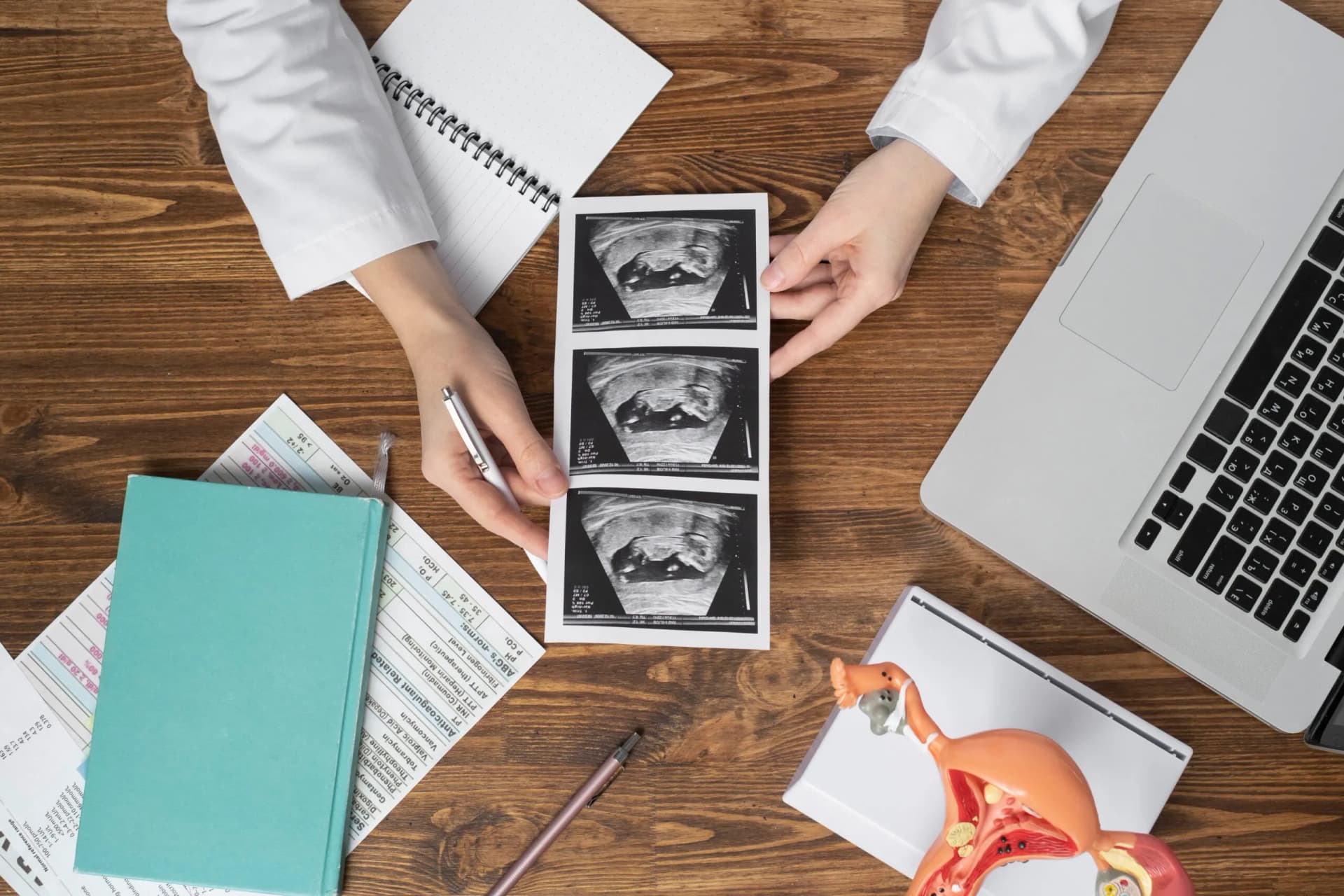 top-view-hands-holding-ultrasounds